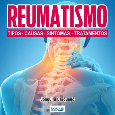 Reumatismo