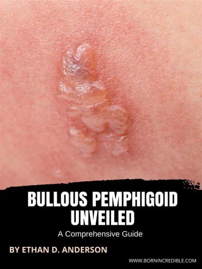 Bullous Pemphigoid Unveiled