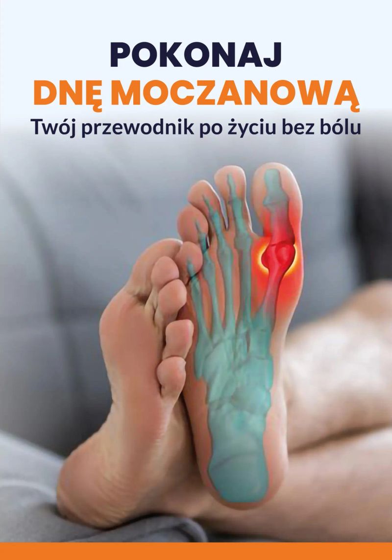 Pokonaj dnę moczanową: Twój przewodnik po życiu bez bólu