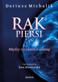 Rak piersi. Między ryzykiem a szansą