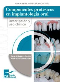 Componentes protésicos en implantología oral