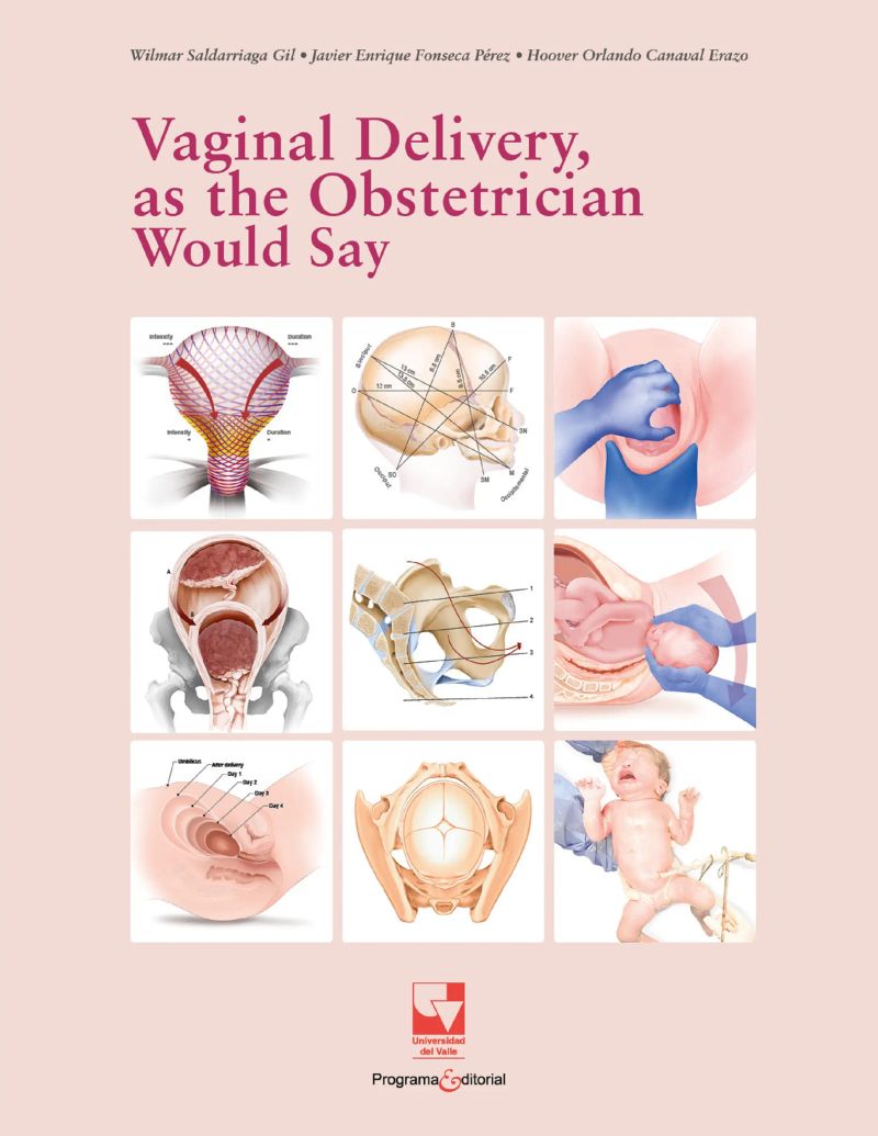Vaginal Delivery, as the Obstetrician Would Say